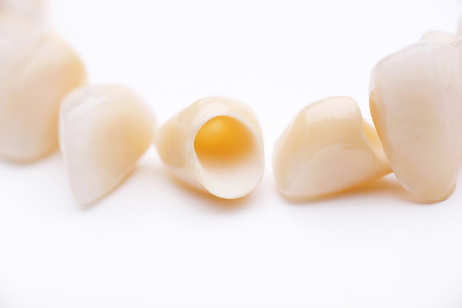 dental crown model for patients in Charlestown NSW