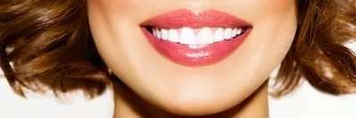 A smiling woman | Veneers Charlestown NSW