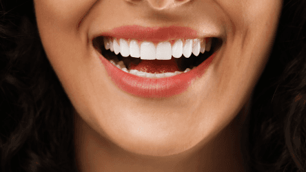 Close-up of a woman smiling with bright white teeth.
