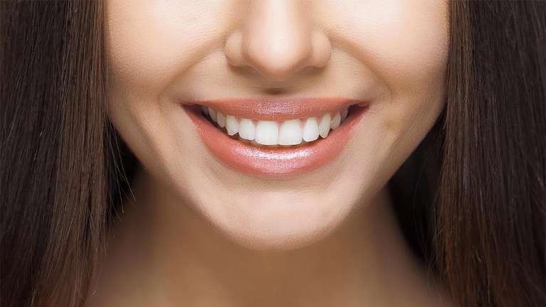 Woman smiling | Straight teeth Charlestown